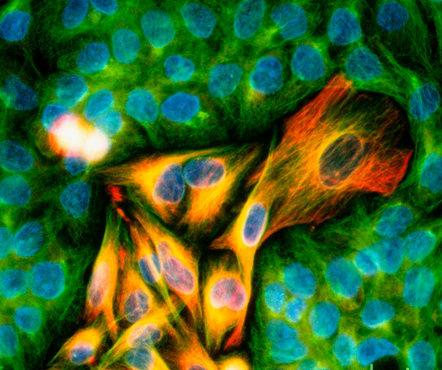Prevenzione melanoma